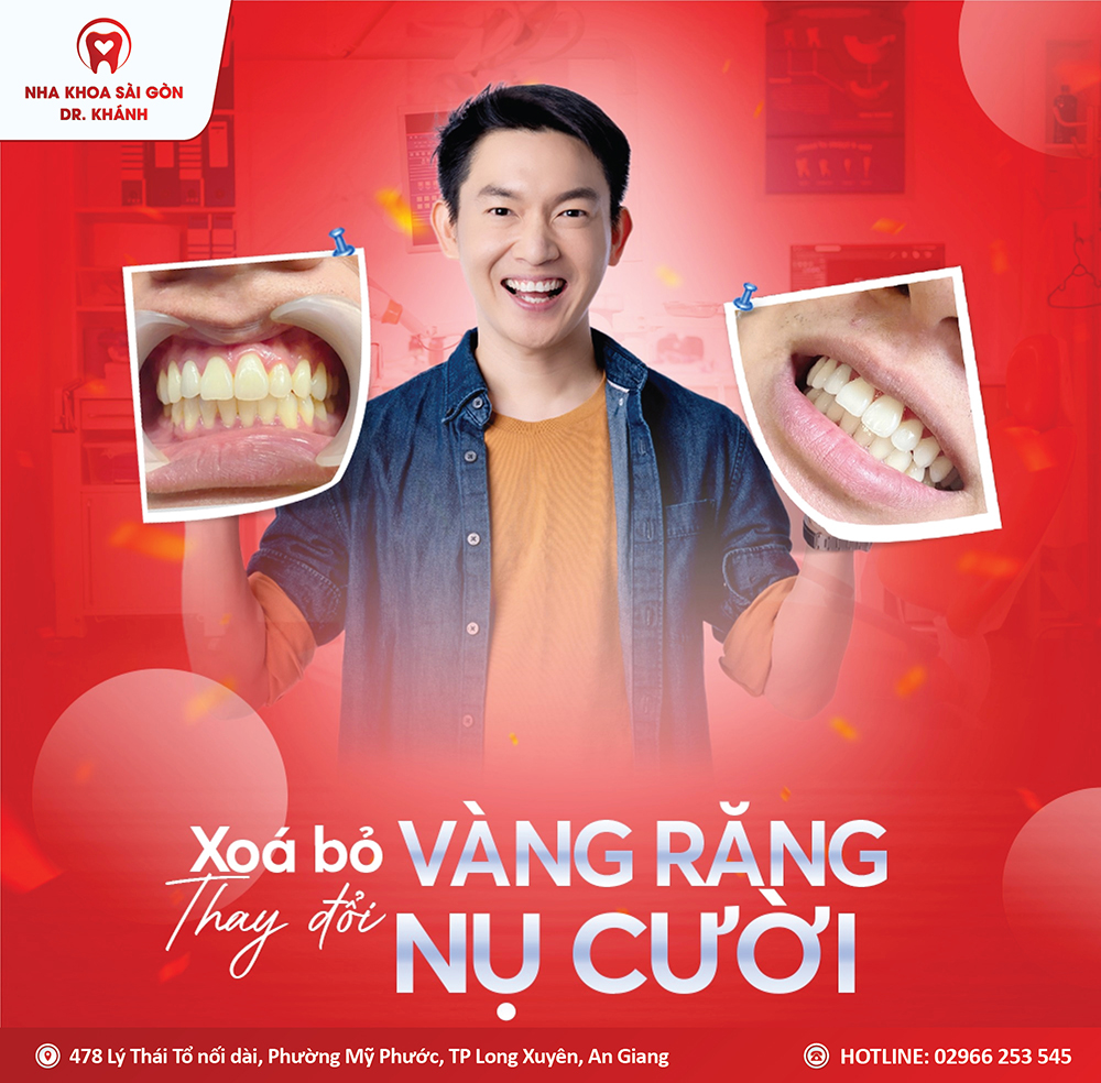 XÓA BỎ VÀNG RĂNG THAY ĐỔI NỤ CƯỜI