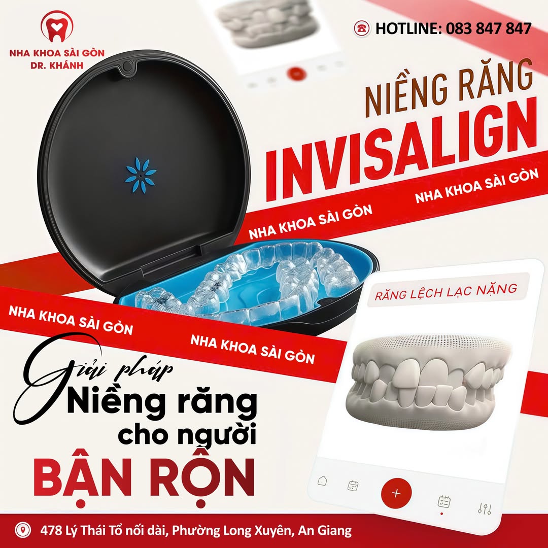 INVISALIGN – NIỀNG RĂNG VÔ HÌNH