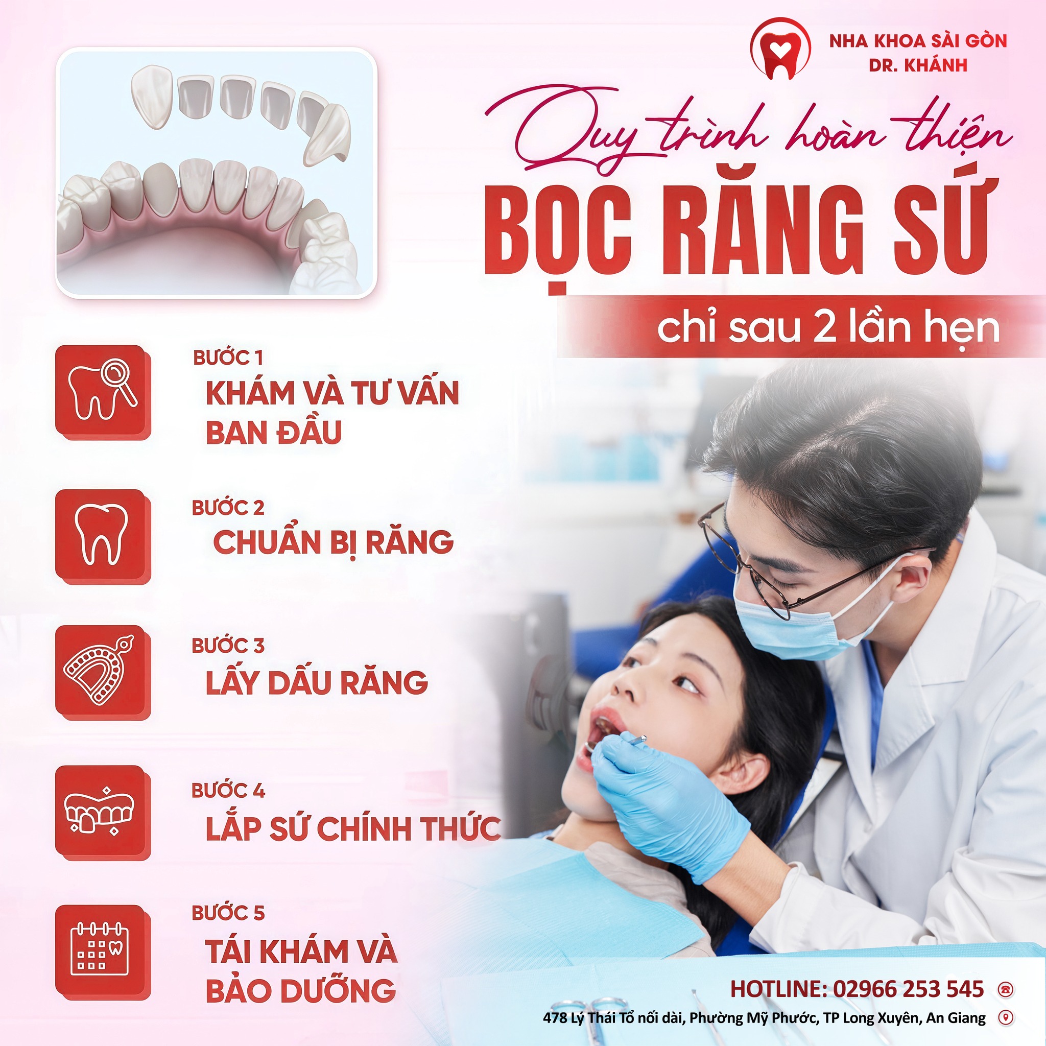 HOÀN THIỆN BỌC RĂNG SỨ CHỈ SAU 2 LẦN HẸN